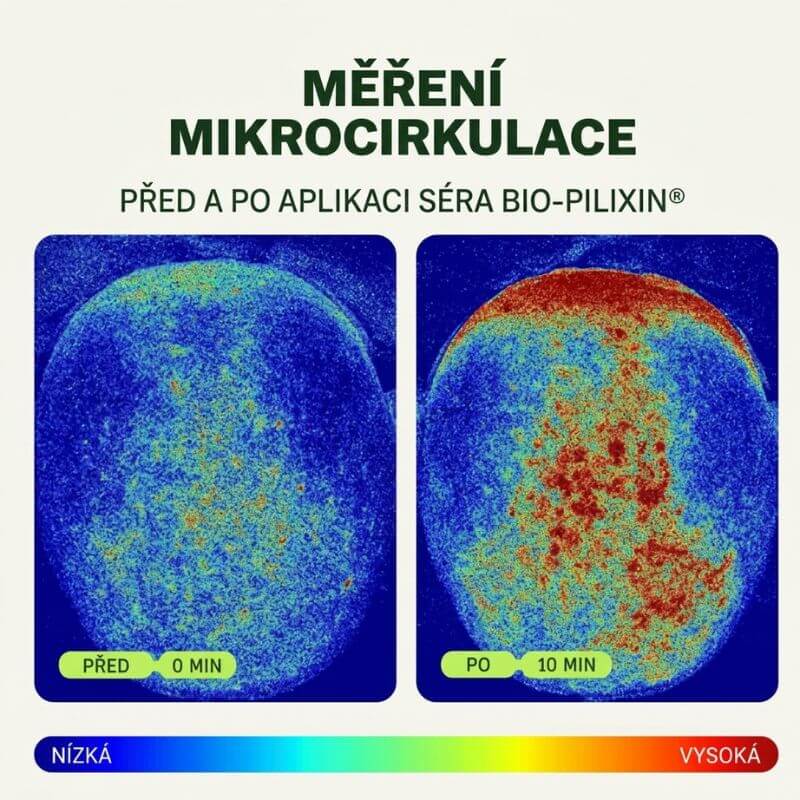 Měření aktivity mikrocirkulace pokožky hlavy před aplikací a 15 minut po aplikaci séra Bio-Pilixin