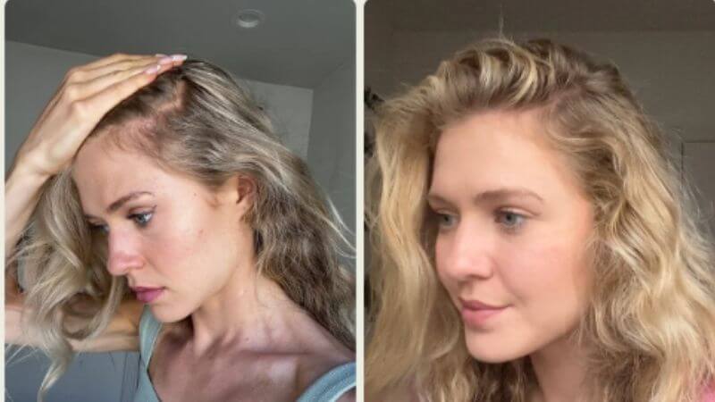 Sophie před zahájením a po používání produktů Scandinavian Biolabs