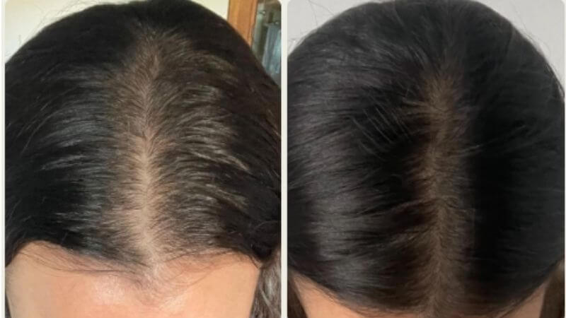 Rafaella Nieto před zahájením a po používání produktů Bio-Pilixin