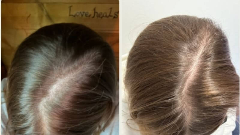Helen před zahájením a po pravidelném používání produktů Scandinavian Biolabs