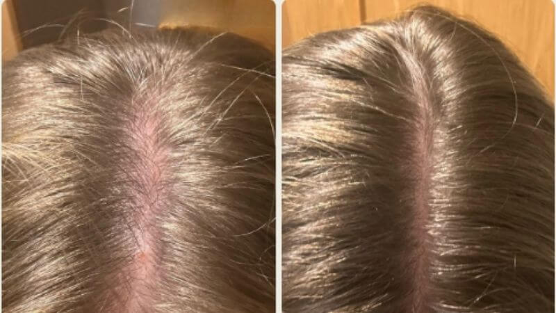 Tetiana před zahájením a po používání produktů Scandinavian Biolabs